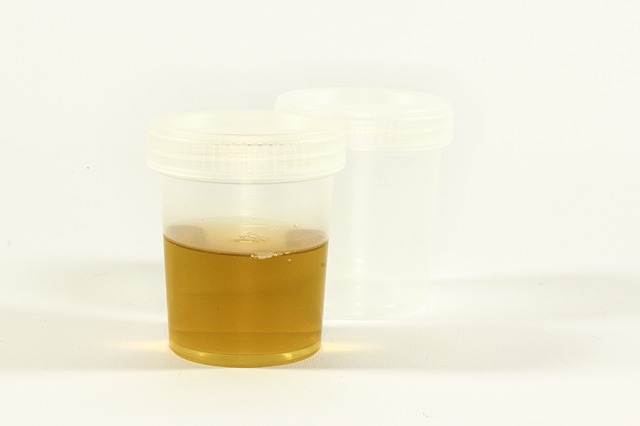 Ihre hufigsten Fragen zur Urinprobe - MVZ Hausrzte Schwalm-Nette
